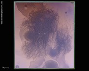 gram-positive bacteria